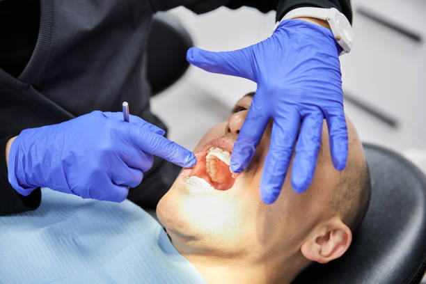 Best Emergency Wisdom Teeth Removal in Vauxhall, NJ