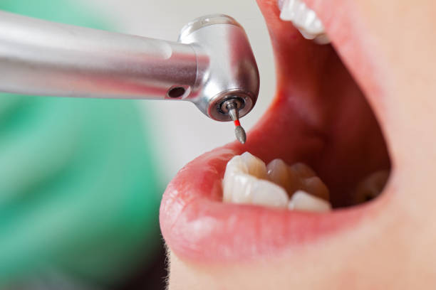 Best Emergency Root Canal Treatment in Vauxhall, NJ